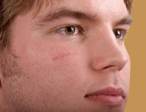 Scar face